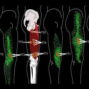 Trigger Point Massage Tools - Mobilization Magic