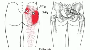 ANMOIST Piriformis Ball 2.5'' Trigger Point Massage Relief for Hip Pain,  Sciatica